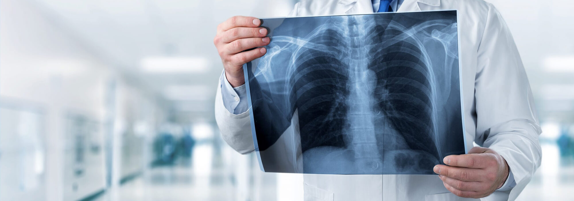 Médecin regardant une radiographie des poumons