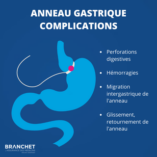 Complications chirurgie bariatrique : comment les gérer et les éviter