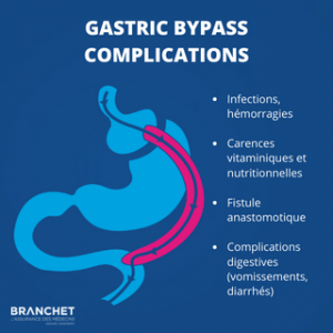 Complications Chirurgie Bariatrique Comment Les Gérer Et Les éviter