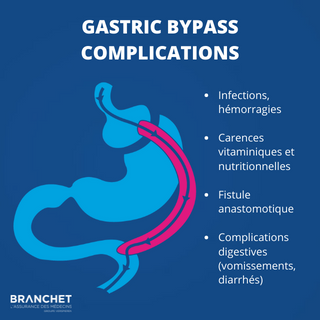 Complications chirurgie bariatrique : comment les gérer et les éviter